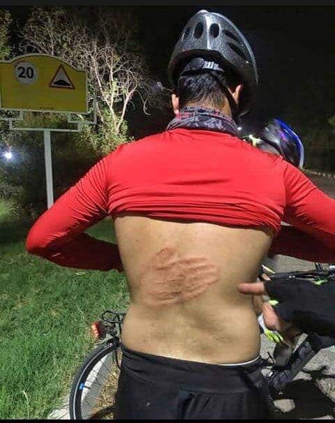 آزار و اذیت دوچرخه سوار