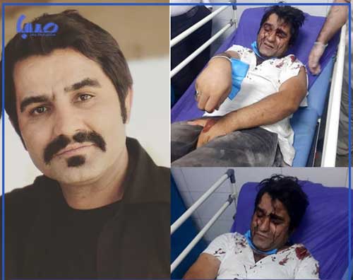 حمله به بازیگر دودکش