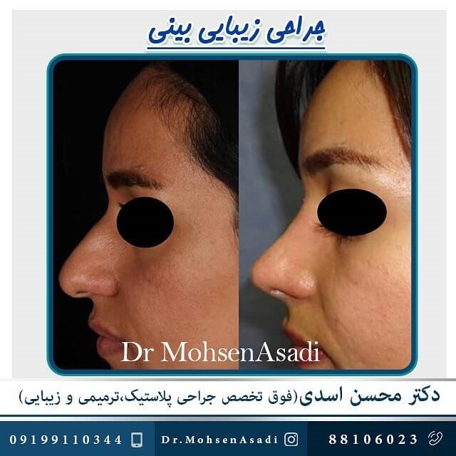 بهترین جراح بینی