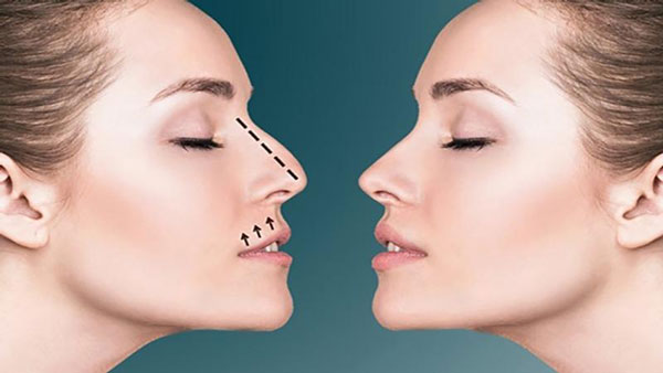 بهترین جراحی بینی