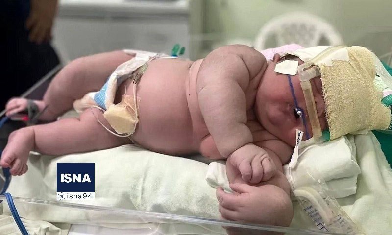 به دنیا آمدن نوزاد 7 کیلویی در مشهد