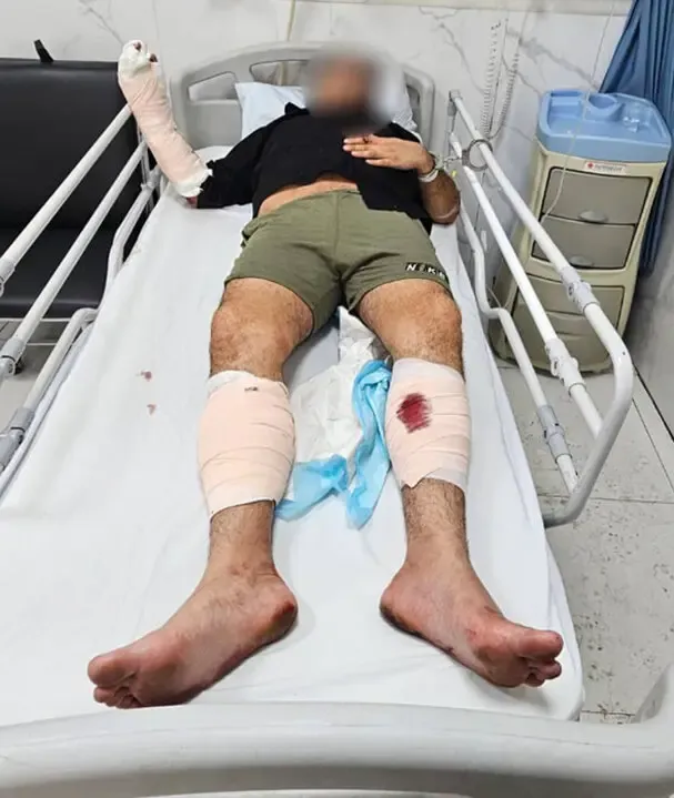 تیر خوردن بلاگر آزار دهنده زنان